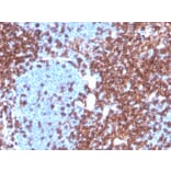 Immunohistochemistry - Anti-CD4 Antibody [CD4/3619R] (A250520) - Antibodies.com