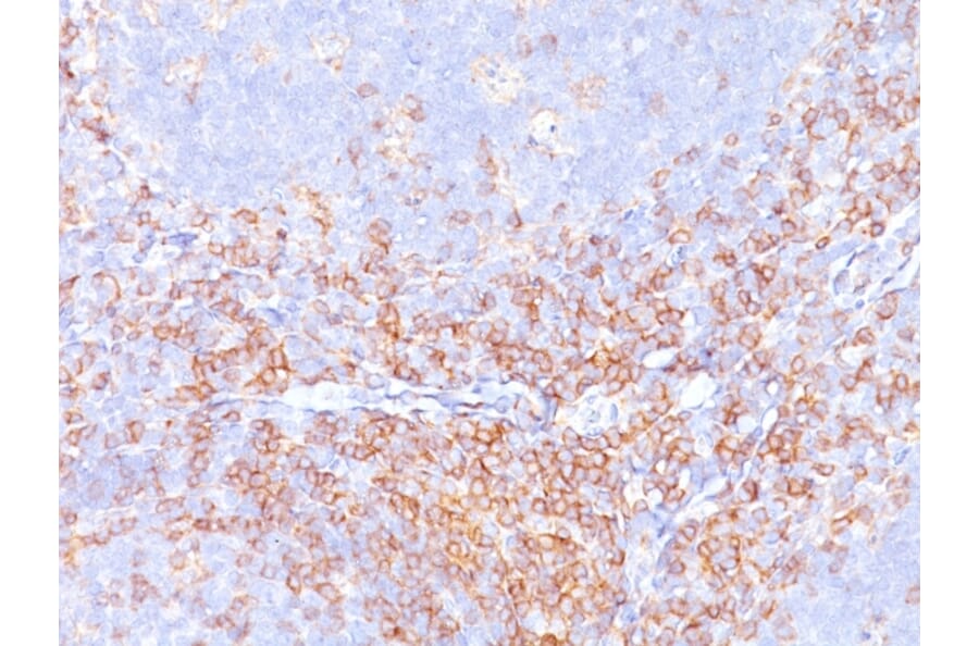 Immunohistochemistry - Anti-CD4 Antibody [CD4/3619R] (A250520) - Antibodies.com