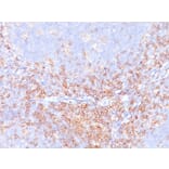 Immunohistochemistry - Anti-CD4 Antibody [CD4/3619R] (A250520) - Antibodies.com