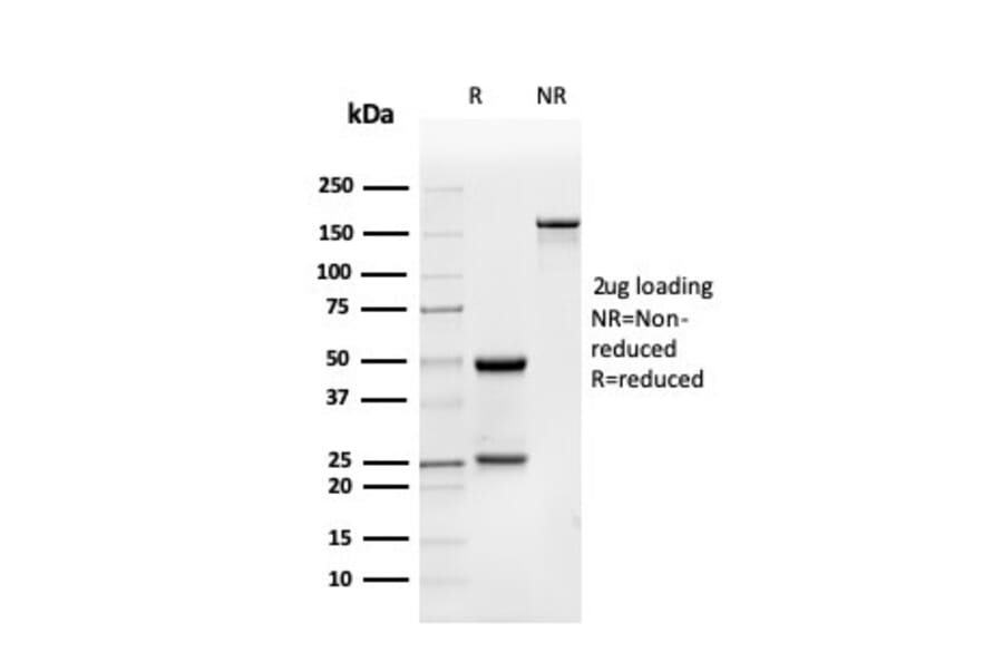 SDS-PAGE - Anti-BMP15 Antibody [BMP15/4263] (A250520) - Antibodies.com