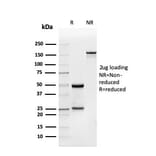 SDS-PAGE - Anti-BMP15 Antibody [BMP15/4263] (A250520) - Antibodies.com