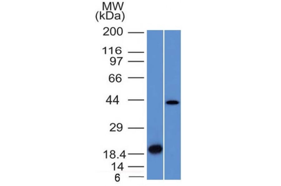 Western Blot - Anti-Aurora B Antibody [AURKB/1521] (A250522) - Antibodies.com