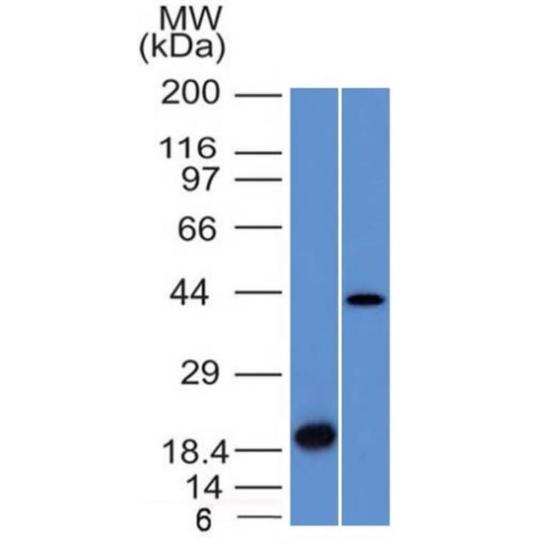 Western Blot - Anti-Aurora B Antibody [AURKB/1521] (A250522) - Antibodies.com
