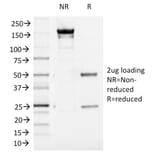 SDS-PAGE - Anti-Aurora B Antibody [AURKB/1521] (A250521) - Antibodies.com
