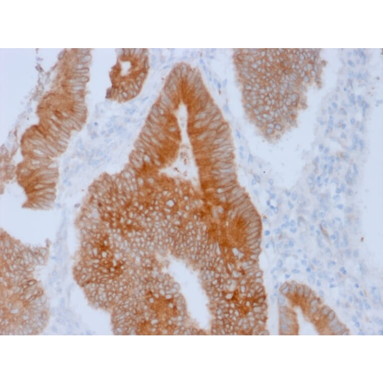 Immunohistochemistry - Anti-Aurora B Antibody [AURKB/1592] (A250522) - Antibodies.com