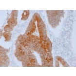 Immunohistochemistry - Anti-Aurora B Antibody [AURKB/1592] (A250522) - Antibodies.com