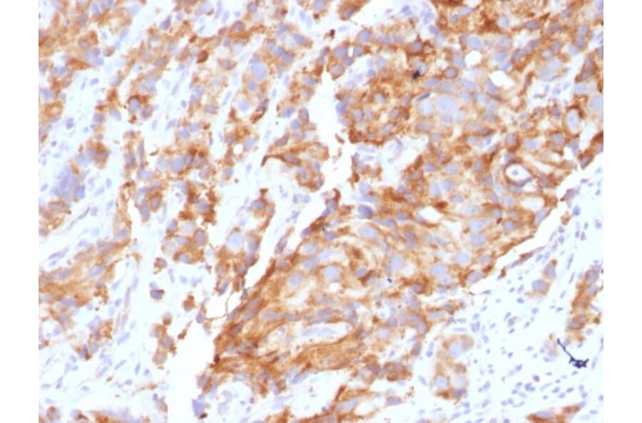 Immunohistochemistry - Anti-Aurora B Antibody [AURKB/1592] (A250523) - Antibodies.com