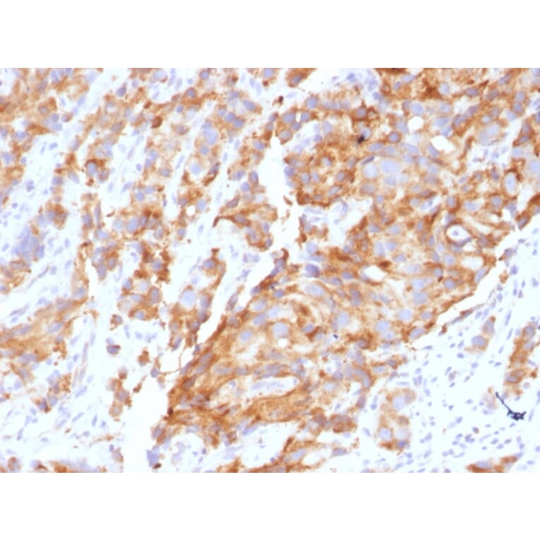 Immunohistochemistry - Anti-Aurora B Antibody [AURKB/1592] (A250523) - Antibodies.com