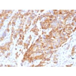 Immunohistochemistry - Anti-Aurora B Antibody [AURKB/1592] (A250523) - Antibodies.com