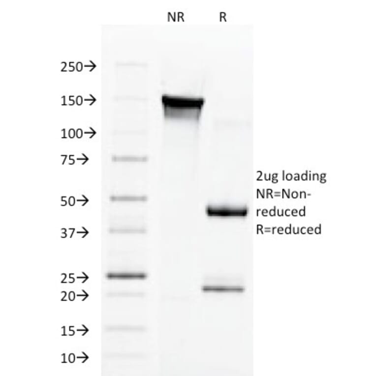 SDS-PAGE - Anti-Aurora B Antibody [AURKB/1592] (A250523) - Antibodies.com