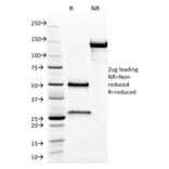 SDS-PAGE - Anti-Aurora B Antibody [AURKB/1593] (A250524) - Antibodies.com