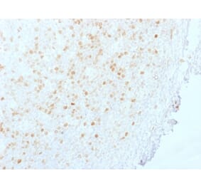 Immunohistochemistry - Anti-Aurora B Antibody [AURKB/1845] (A250524) - Antibodies.com