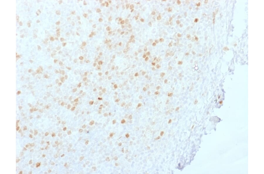 Immunohistochemistry - Anti-Aurora B Antibody [AURKB/1845] (A250524) - Antibodies.com