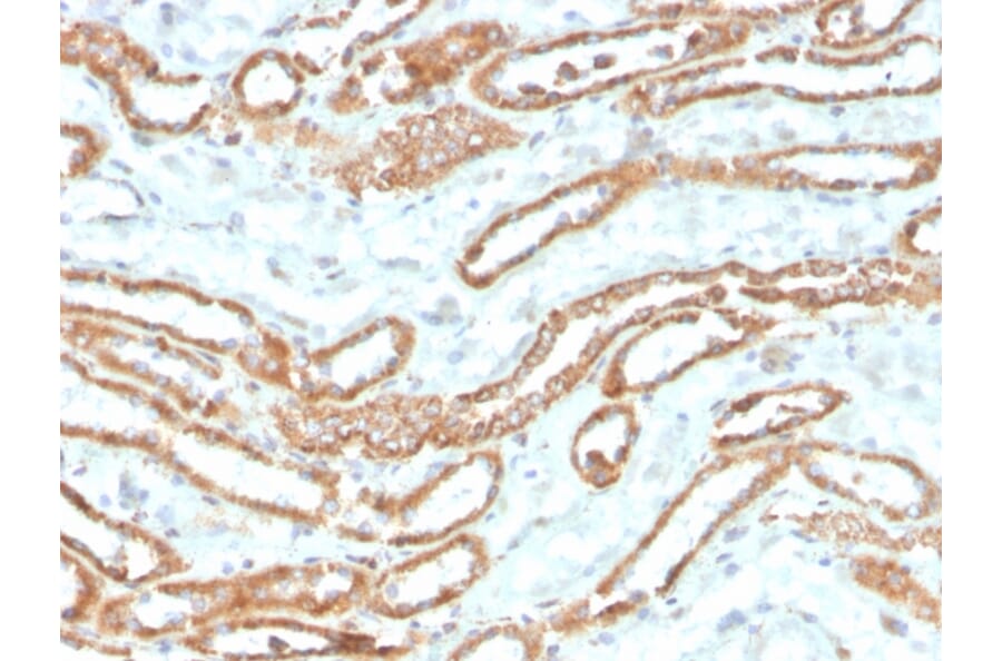 Immunohistochemistry - Anti-Aurora B Antibody [rAURKB/1592] (A250526) - Antibodies.com