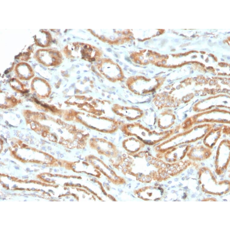 Immunohistochemistry - Anti-Aurora B Antibody [rAURKB/1592] (A250525) - Antibodies.com