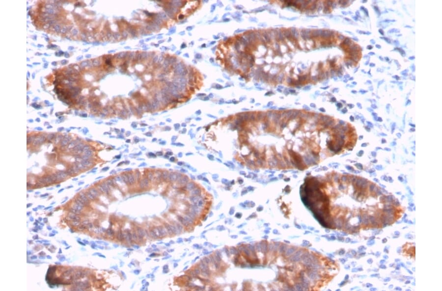 Immunohistochemistry - Anti-Aurora B Antibody [AURKB/3121R] (A250526) - Antibodies.com
