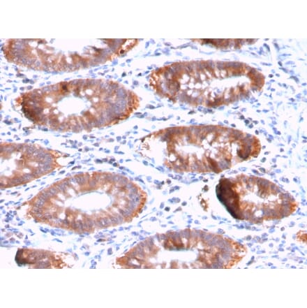 Immunohistochemistry - Anti-Aurora B Antibody [AURKB/3121R] (A250526) - Antibodies.com