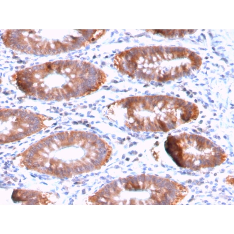 Immunohistochemistry - Anti-Aurora B Antibody [AURKB/3121R] (A250526) - Antibodies.com