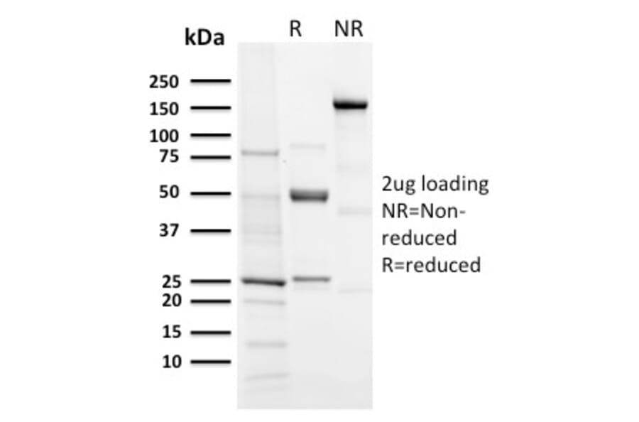 SDS-PAGE - Anti-Aurora B Antibody [AURKB/3121R] (A250527) - Antibodies.com