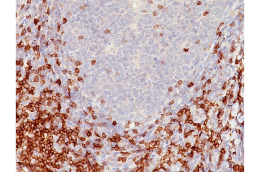 Immunohistochemistry - Anti-CD5 Antibody [C5/473] (A250527) - Antibodies.com