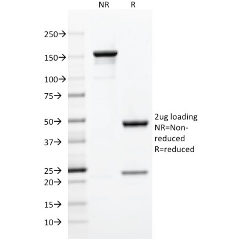 SDS-PAGE - Anti-CD5 Antibody [C5/473] (A250528) - Antibodies.com