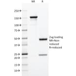 SDS-PAGE - Anti-CD5 Antibody [C5/473] (A250528) - Antibodies.com