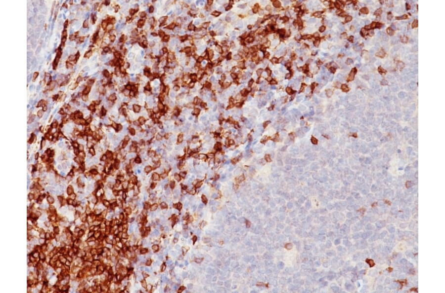 Immunohistochemistry - Anti-CD5 Antibody [SPM546] (A250528) - Antibodies.com