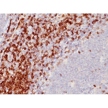 Immunohistochemistry - Anti-CD5 Antibody [SPM546] (A250528) - Antibodies.com