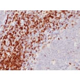 Immunohistochemistry - Anti-CD5 Antibody [SPM546] (A250528) - Antibodies.com