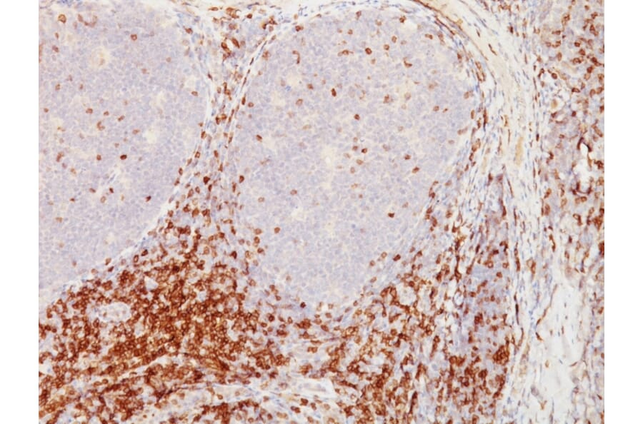 Immunohistochemistry - Anti-CD5 Antibody [CD5/54/F6] (A250529) - Antibodies.com