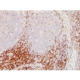 Immunohistochemistry - Anti-CD5 Antibody [CD5/54/F6] (A250529) - Antibodies.com
