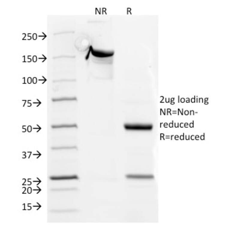 SDS-PAGE - Anti-CD5 Antibody [CD5/54/F6] (A250530) - Antibodies.com