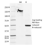 SDS-PAGE - Anti-CD5 Antibody [CD5/54/F6] (A250530) - Antibodies.com