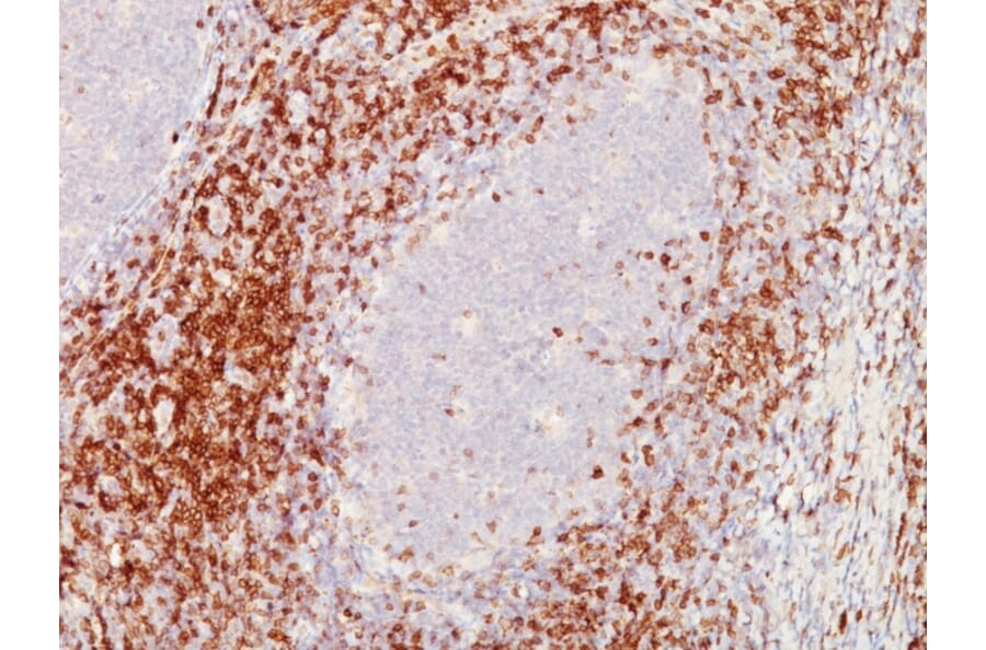 Immunohistochemistry - Anti-CD5 Antibody [C5/473 + CD5/54/F6] (A250530) - Antibodies.com