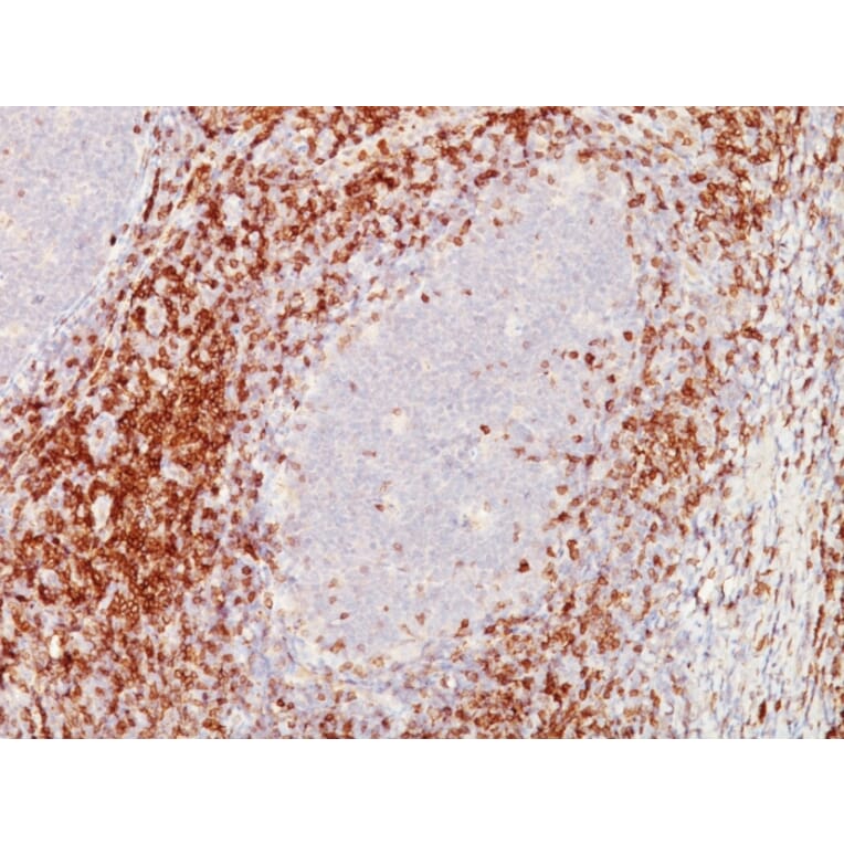Immunohistochemistry - Anti-CD5 Antibody [C5/473 + CD5/54/F6] (A250530) - Antibodies.com