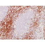 Immunohistochemistry - Anti-CD5 Antibody [C5/473 + CD5/54/F6] (A250530) - Antibodies.com