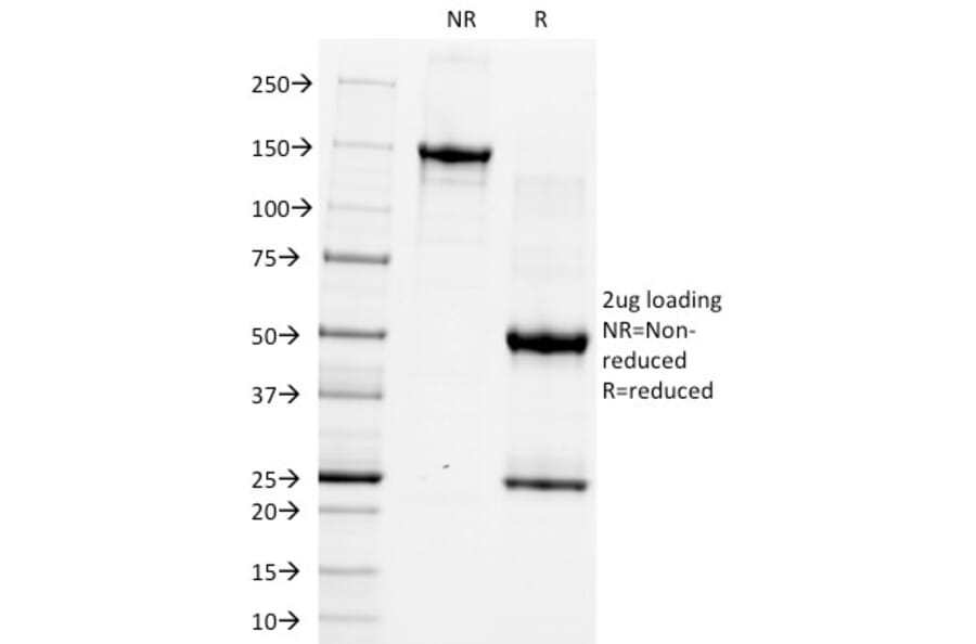 SDS-PAGE - Anti-CD5 Antibody [CRIS-1] (A250532) - Antibodies.com