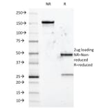 SDS-PAGE - Anti-CD5 Antibody [B-B8] (A250532) - Antibodies.com