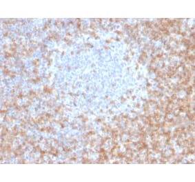 Immunohistochemistry - Anti-CD5 Antibody [CD5/2416] (A250534) - Antibodies.com
