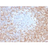 Immunohistochemistry - Anti-CD5 Antibody [CD5/2416] (A250534) - Antibodies.com