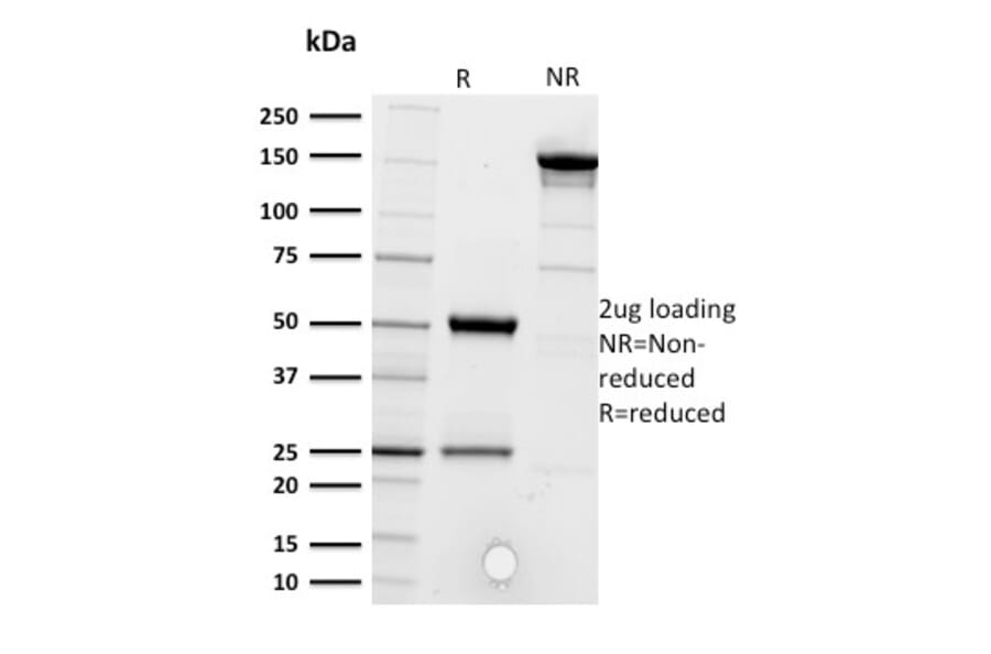 SDS-PAGE - Anti-CD5 Antibody [CD5/2416] (A250534) - Antibodies.com