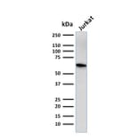 Western Blot - Anti-CD5 Antibody [CD5/2416] (A250534) - Antibodies.com