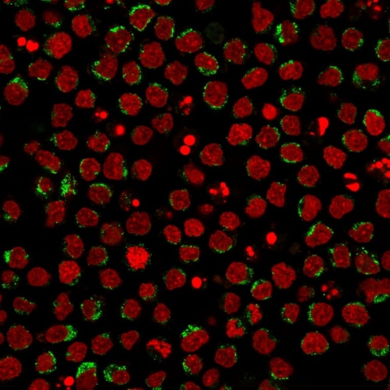 Immunofluorescence - Anti-CD5 Antibody [CD5/2416] (A250534) - Antibodies.com