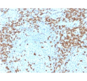 Immunohistochemistry - Anti-CD5 Antibody [CD5/2418] (A250535) - Antibodies.com