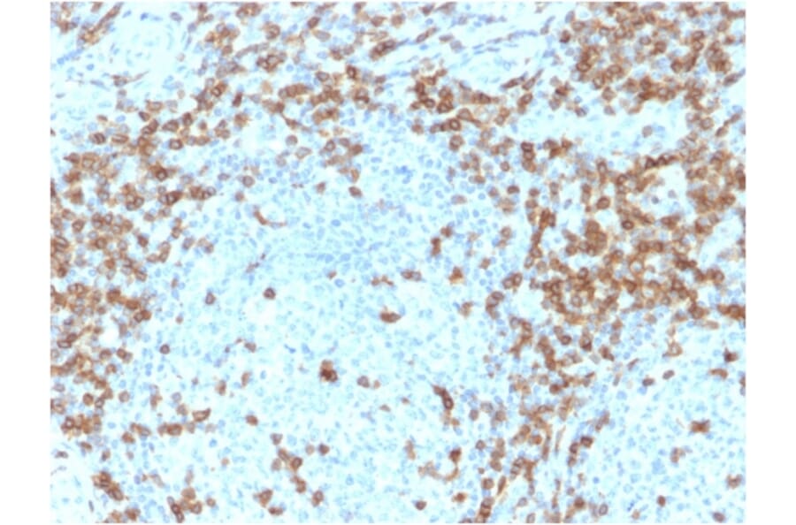 Immunohistochemistry - Anti-CD5 Antibody [CD5/2418] (A250535) - Antibodies.com
