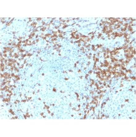 Immunohistochemistry - Anti-CD5 Antibody [CD5/2418] (A250535) - Antibodies.com