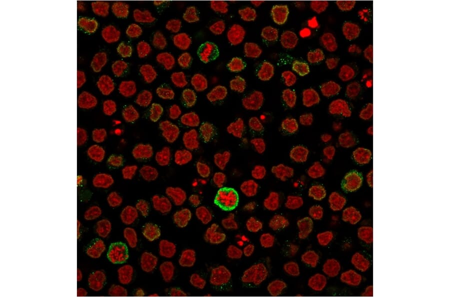 Immunofluorescence - Anti-CD5 Antibody [CD5/2418] (A250535) - Antibodies.com