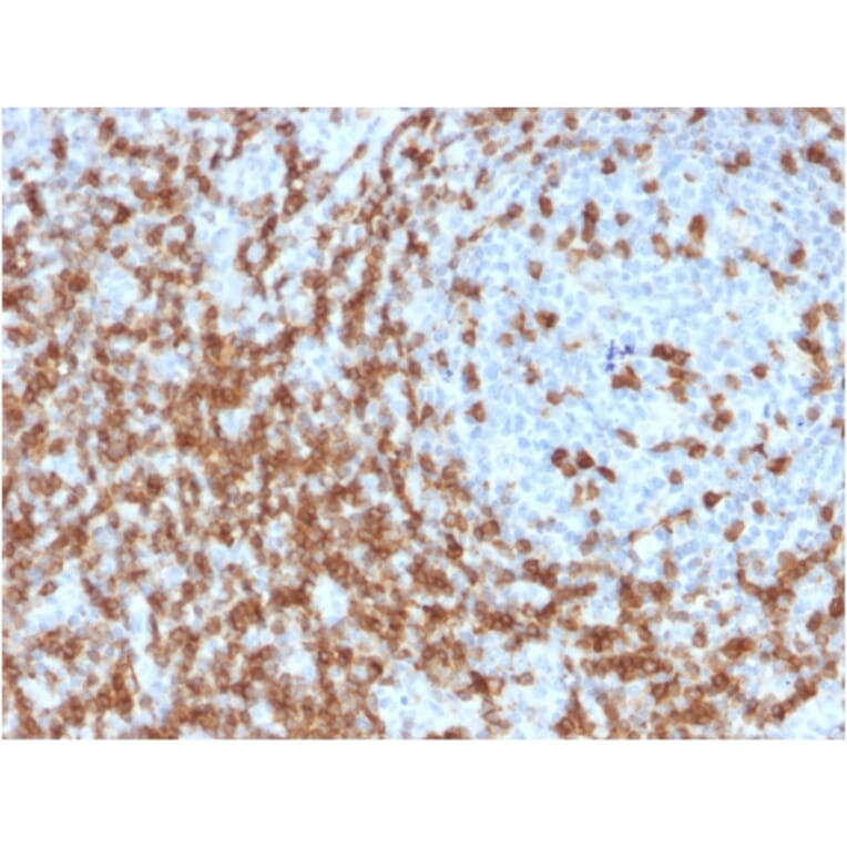 Immunohistochemistry - Anti-CD5 Antibody [CD5/2419] (A250536) - Antibodies.com