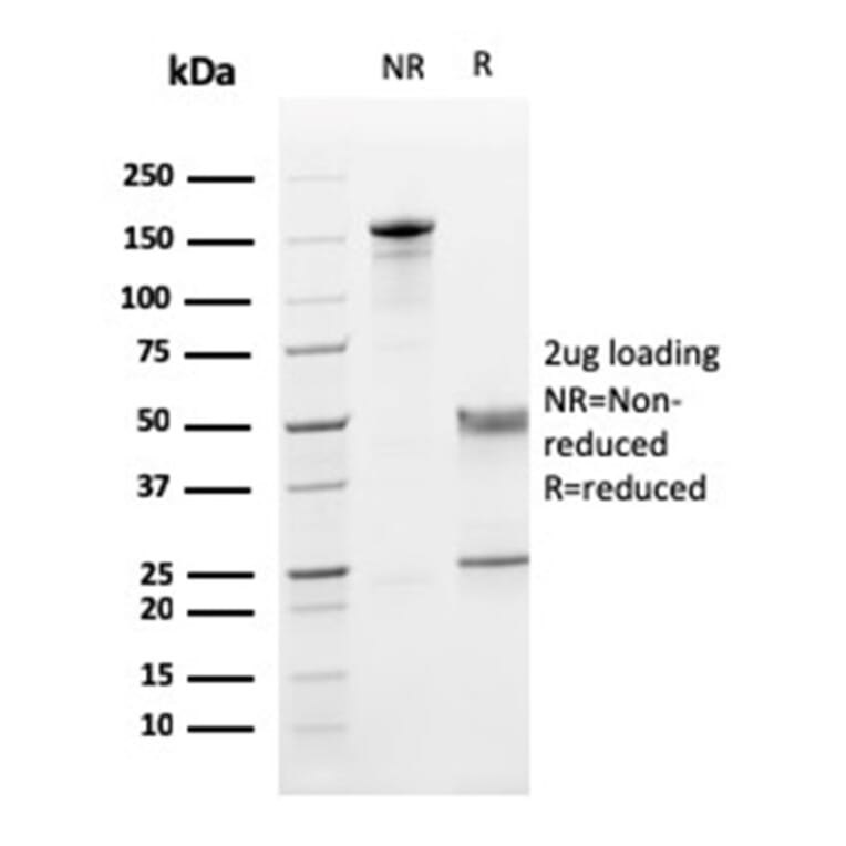 SDS-PAGE - Anti-CD5 Antibody [CD5/2419] (A250536) - Antibodies.com