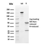 SDS-PAGE - Anti-CD5 Antibody [CD5/2419] (A250536) - Antibodies.com